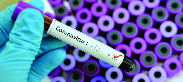CORONAVIRUS - Diagnostico